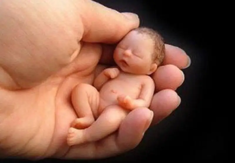 A QUEM REALMENTE INTERESSA A LEGALIZAÇÃO DO ABORTO?